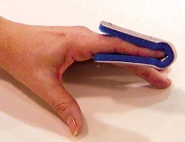 Fold Over Finger Splint Small Bulk  PK/6 Non-Retail